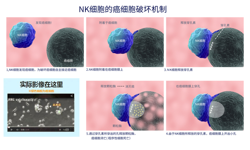 NK细胞.jpg